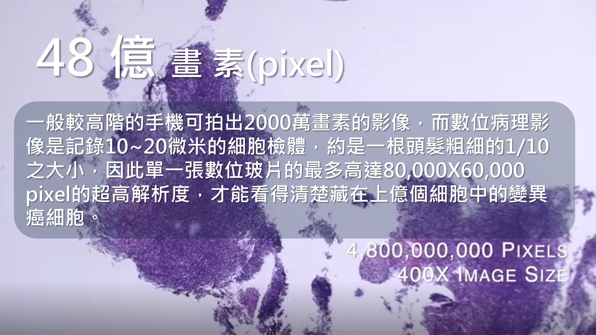 小知識(1)-48億畫素:一般較高階的手機可拍出2000萬畫素的影像,而數位病理影像是記錄10~20微米的細胞檢體,約是一根頭髮粗細的1/10之大小
